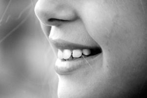 Sbiancamneto professionale